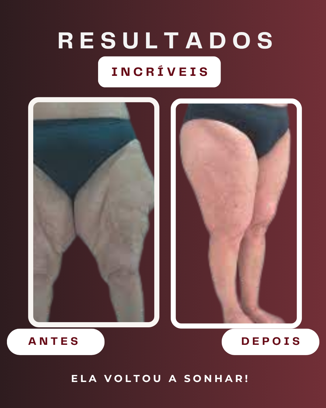 Transformação - Ela voltou a sonhar