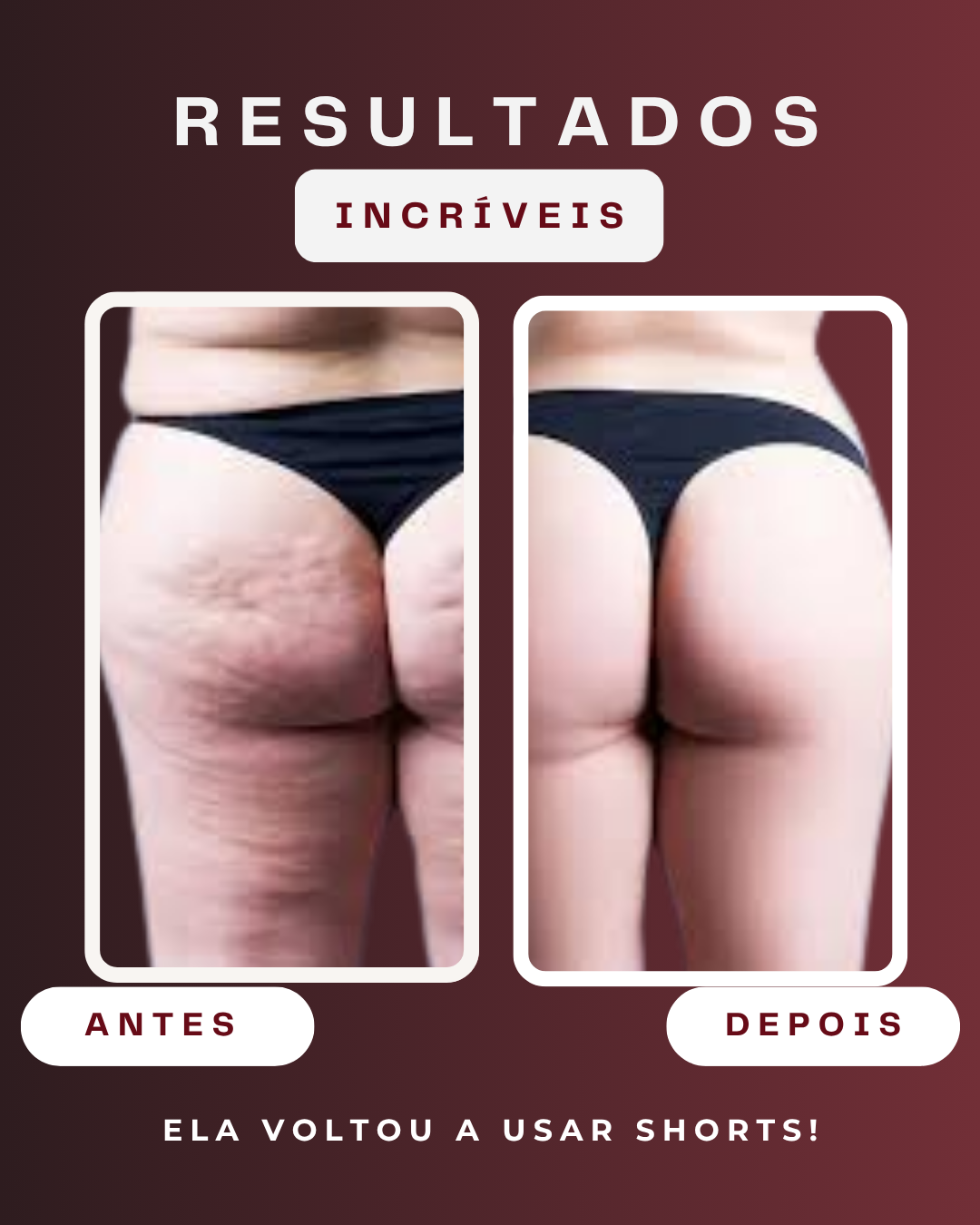 Voltou a usar shorts