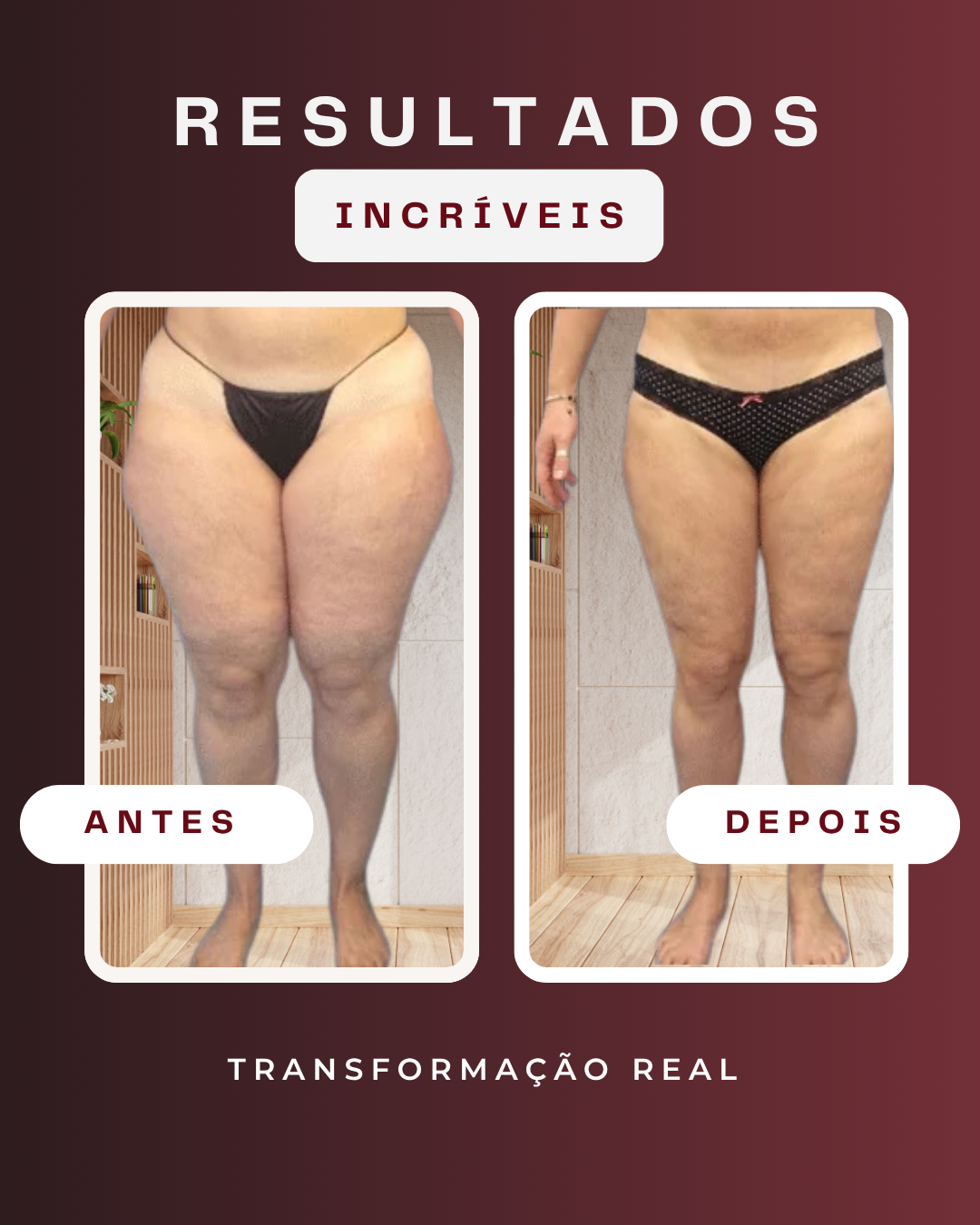 Transformação real - Pernas Leves